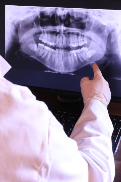 Best Dentist for Tooth Abscess  in Napa, CA