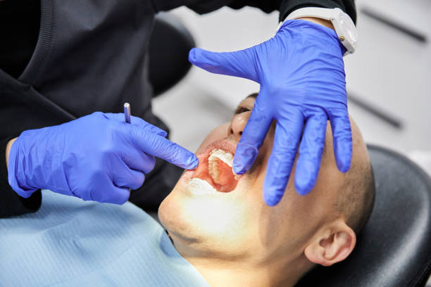 Best Chipped Tooth Repair Near Me  in Napa, CA